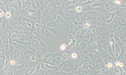 质粒载体网ECV-304人膀胱癌细胞