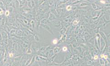质粒载体网ECV-304人膀胱癌细胞