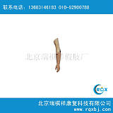 北京瑞祺祥假肢厂供应肘离断假肢 智能假肢;